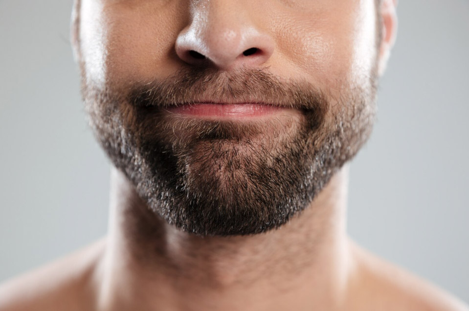 Barttransplantation OFM